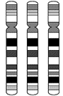 trisomy18.gif